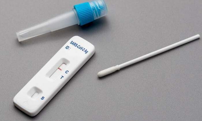 Sanidad rechaza la oferta de vender tests de antígenos en supermercados